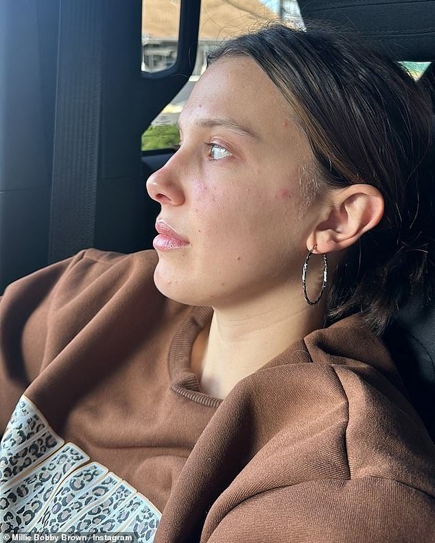 Millie Bobby Brown foi elogiada por compartilhar uma foto sua sem maquiagem e detalhar como ela lida com a acne