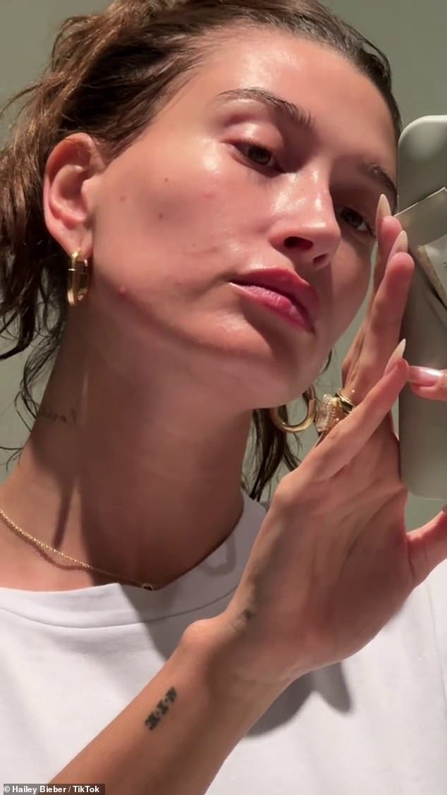 Hailey Bieber, 27 anos, ficou sem maquiagem em um vídeo do TikTok para falar sobre sua experiência com dermatite perioral e como ela lida com isso